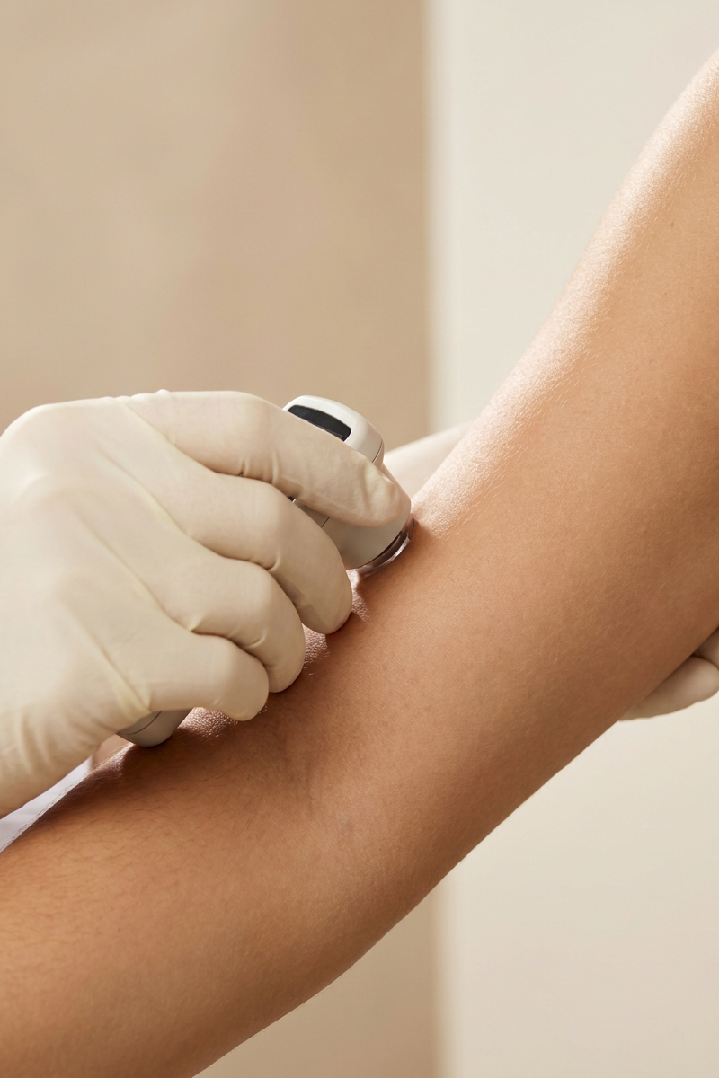 Bilan découverte laser à Wettolsheim — Mystique Glow